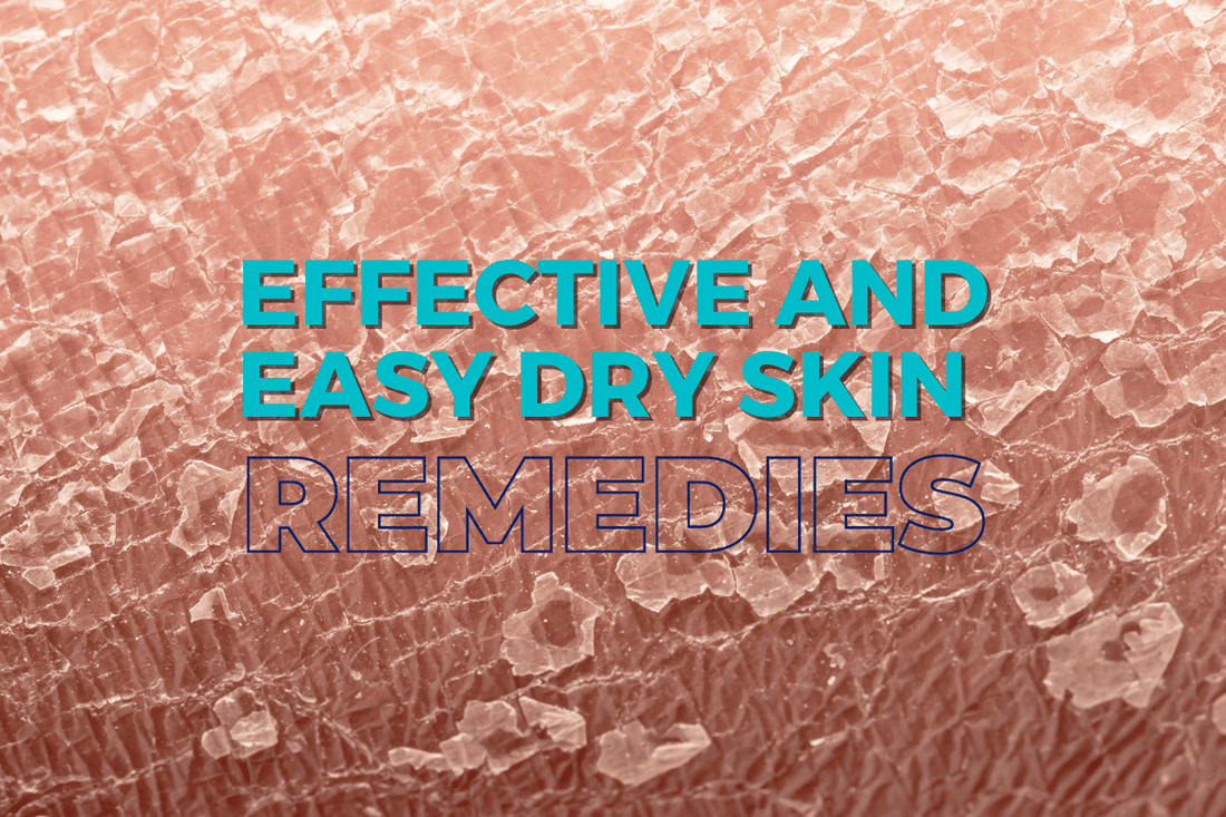 Effective and Easy Dry Skin Remedies - HueVine Wellness + Spa