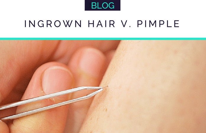 INGROWN HAIR V.S. PIMPLE: HOW TO TELL THE DIFFERENCE - HueVine Wellness + Spa